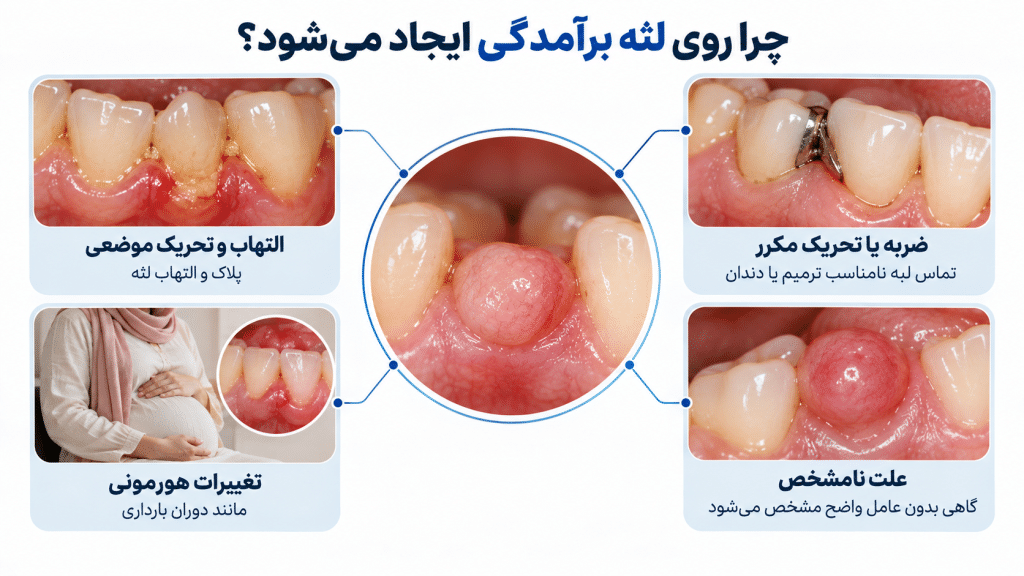 چرا روی لثه برآمدگی ایجاد میشود؟
